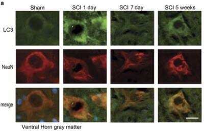 Staining of LC3 in Rat Neurons