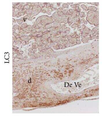 LC3 Localization in Villous and Extravillous Trophoblasts