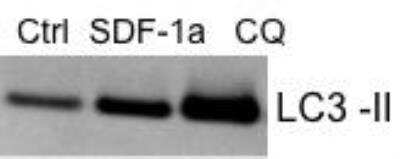 Western Blot Detection of LC3B in Cancer Cells