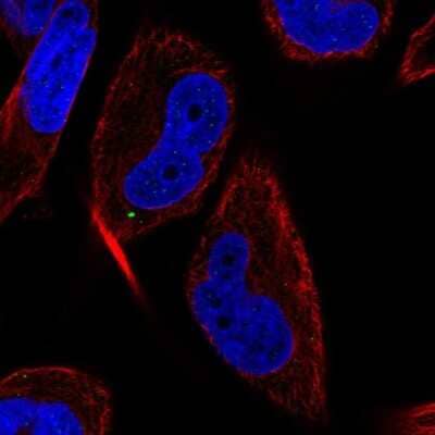 Immunocytochemistry/ Immunofluorescence: LC3C Antibody [NBP2-57604]