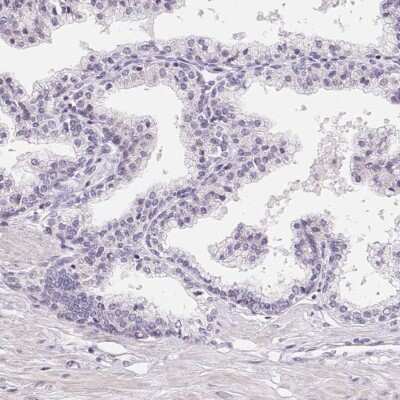 Immunohistochemistry-Paraffin: LCA5L Antibody [NBP2-58163]