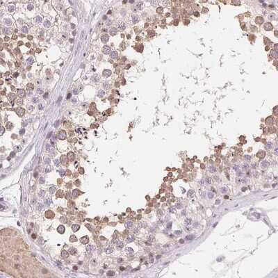 Immunohistochemistry-Paraffin: LCA5L Antibody [NBP2-58163]