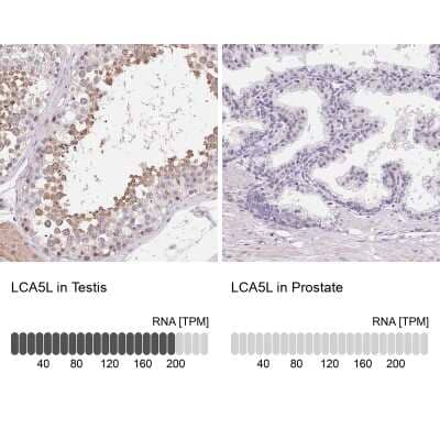 Immunohistochemistry-Paraffin: LCA5L Antibody [NBP2-58163]