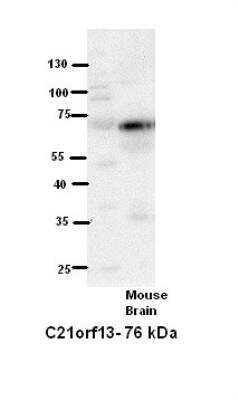 Western Blot: LCA5L Antibody [NBP1-70597]