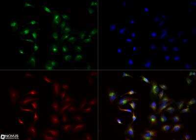 Immunocytochemistry/ Immunofluorescence: LCAT Antibody [NBP1-05950]