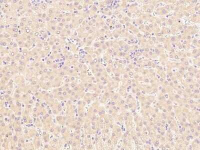 Immunohistochemistry-Paraffin: LCAT Antibody [NBP3-00108]