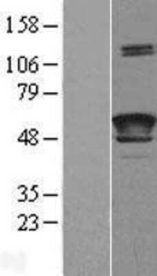 Western Blot: LCAT Overexpression Lysate [NBL1-12457]