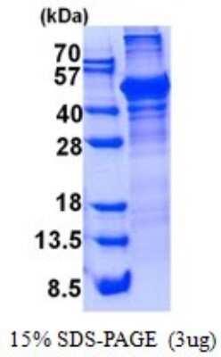 SDS-PAGE: Recombinant Human LCAT His Protein [NBP2-53036]