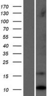 Western Blot: LCE1C Overexpression Lysate [NBP2-04976]