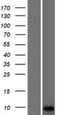 Western Blot: LCE3A Overexpression Lysate [NBP2-04972]