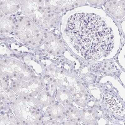 Immunohistochemistry-Paraffin: LCE6A Antibody [NBP1-94116]