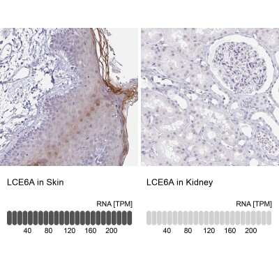 Immunohistochemistry-Paraffin: LCE6A Antibody [NBP1-94116]