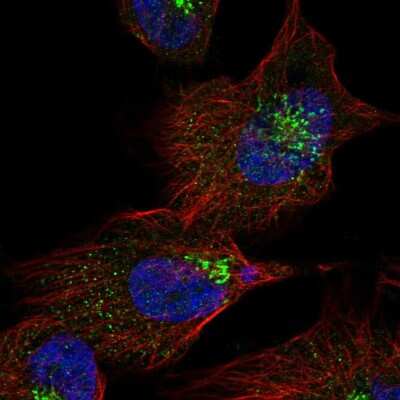 Immunocytochemistry/ Immunofluorescence: LCHN Antibody [NBP2-55849]