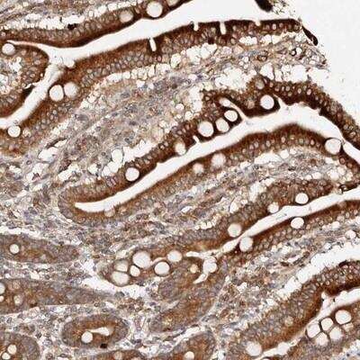 Immunohistochemistry: LCHN Antibody [NBP1-87675]