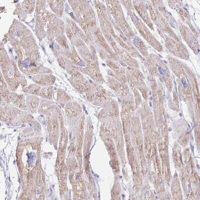 Immunohistochemistry-Paraffin: LCLAT1 Antibody [NBP2-14187]