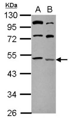 Western Blot: LCLAT1 Antibody [NBP2-19339]