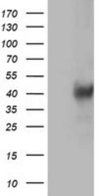 Western Blot: LCMT1 Antibody (OTI2C9) [NBP2-00923]