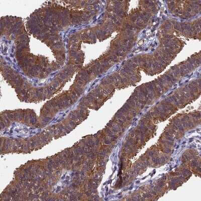 Immunohistochemistry-Paraffin: LCMT1 Antibody [NBP2-14188]