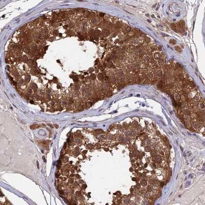 Immunohistochemistry-Paraffin: LCMT1 Antibody [NBP2-14188]