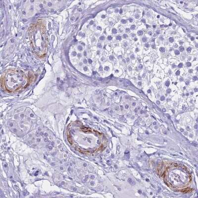 Immunohistochemistry-Paraffin: LCMT1 Antibody [NBP2-14189]