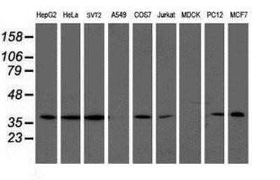 Western Blot: LCMT1 Antibody (OTI2C9)Azide and BSA Free [NBP2-71927]