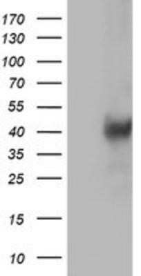 Western Blot: LCMT1 Antibody (OTI2C9)Azide and BSA Free [NBP2-71927]