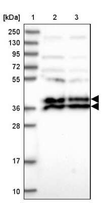 Western Blot: LCMT1 Antibody [NBP2-14188]
