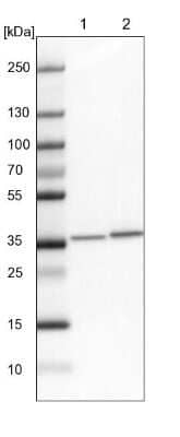 Western Blot: LCMT1 Antibody [NBP2-14188]