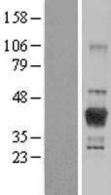 Western Blot: LCMT1 Overexpression Lysate [NBL1-12460]