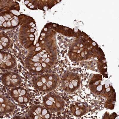 Immunohistochemistry-Paraffin: LCMT2 Antibody [NBP1-82997]