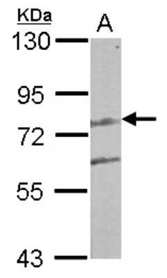 Western Blot: LCMT2 Antibody [NBP2-19340]