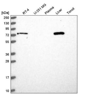 Western Blot: LCMT2 Antibody [NBP2-56384]