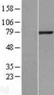 Western Blot: LCMT2 Overexpression Lysate [NBL1-12461]