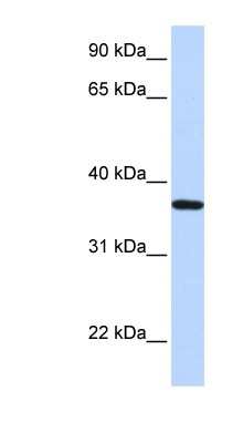 Western Blot: LCN12 Antibody [NBP1-58052]