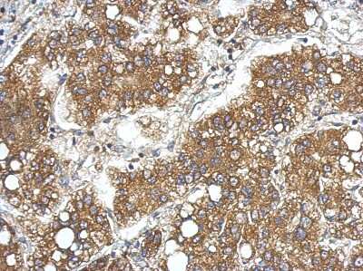 Immunohistochemistry-Paraffin: LCN15 Antibody [NBP2-15017]