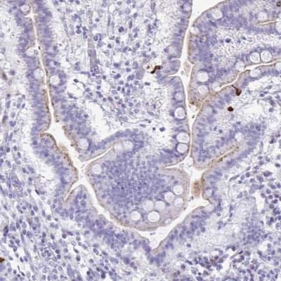 Immunohistochemistry-Paraffin: LCN15 Antibody [NBP2-32557]