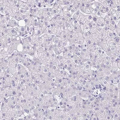 Immunohistochemistry-Paraffin: LCN15 Antibody [NBP2-32557]