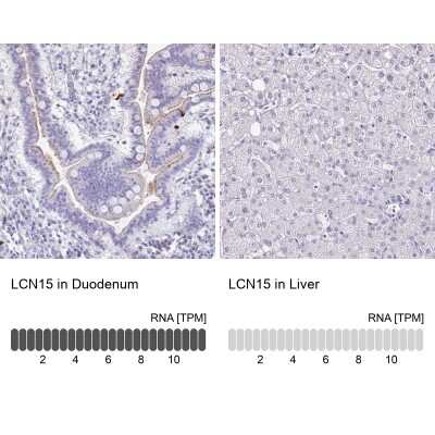 Immunohistochemistry-Paraffin: LCN15 Antibody [NBP2-32557]