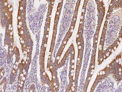 Immunohistochemistry-Paraffin: LCN15 Antibody [NBP3-06604]