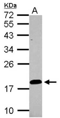 Western Blot: LCN15 Antibody [NBP2-15017]