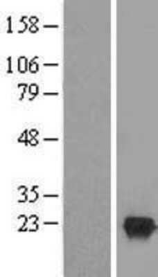 Western Blot: LCN15 Overexpression Lysate [NBL1-17623]