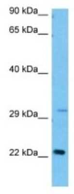 Western Blot: LCN5 Antibody [NBP3-10184]