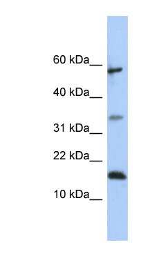 Western Blot: LCN6 Antibody [NBP1-57957]