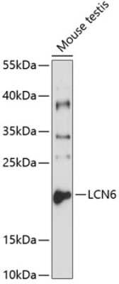 Western Blot: LCN6 AntibodyAzide and BSA Free [NBP3-04897]