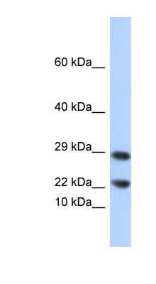 Western Blot: LCN8 Antibody [NBP1-56314]