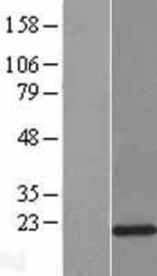 Western Blot: LCN8 Overexpression Lysate [NBP2-04966]