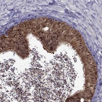 Immunocytochemistry/ Immunofluorescence: LCN9 Antibody [NBP2-68766]