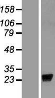 Western Blot: LCN9 Overexpression Lysate [NBP2-08949]