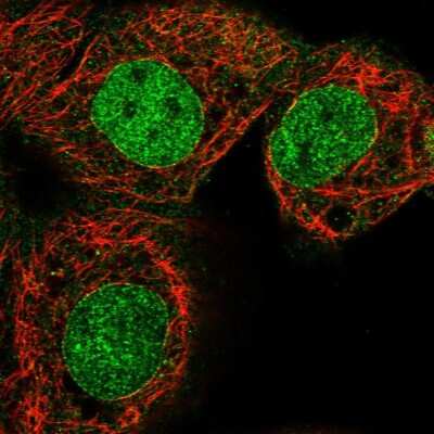 Immunocytochemistry/ Immunofluorescence: LCORL Antibody [NBP1-82037]