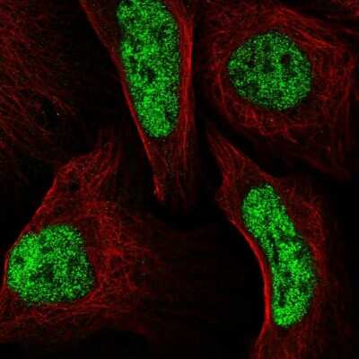 Immunocytochemistry/ Immunofluorescence: LCORL Antibody [NBP2-57168]